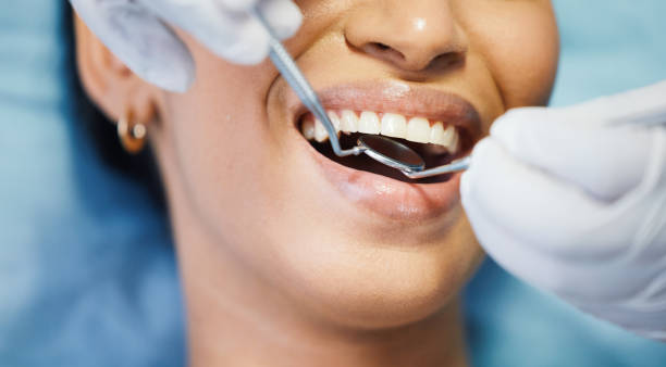 Best Emergency Dental Services for Seniors in North Alamo, TX