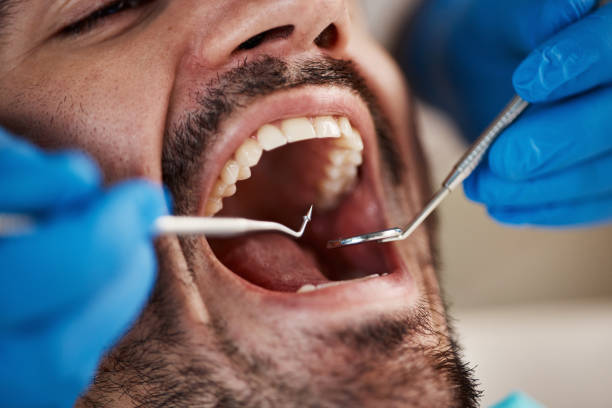Best Holiday Emergency Dentist in North Alamo, TX