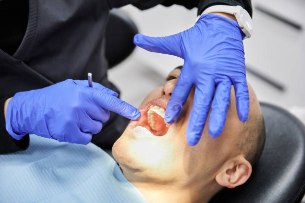 Best Emergency Dental Care for Abscessed Tooth in North Alamo, TX